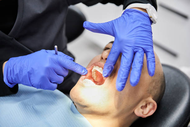 Best Knocked-Out Tooth Emergency  in Orangeburg, NY